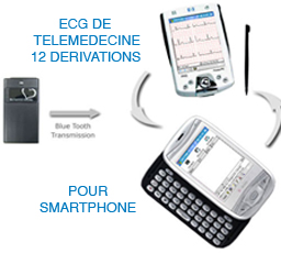 ECG 12 pistes pro TELEMEDECINE pour WINDOWS SMARTPHONE
