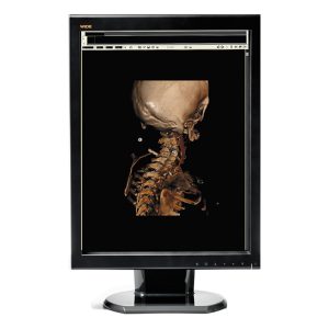Ecrans pour Radiologie,Mammographie, PACS