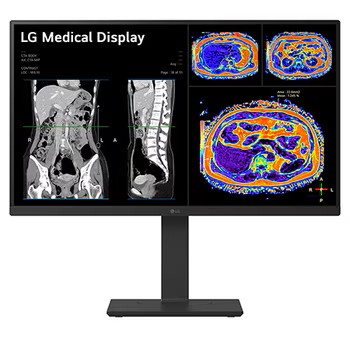 NOUVEAU Ecran LG 32HQ713D-B LED couleur 8MP format 16:9e de visualisation d’ images de Radiologie et Pathologie
