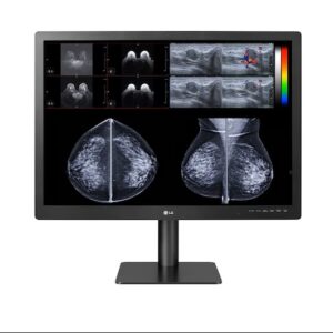 Ecran LG mammographie 31HN713D-M - 12 MP pour la radiologie et la Pathologie