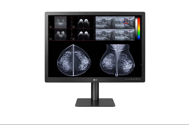 Ecran LG mammographie 31HN713D-M - 12 MP pour la radiologie et la Pathologie