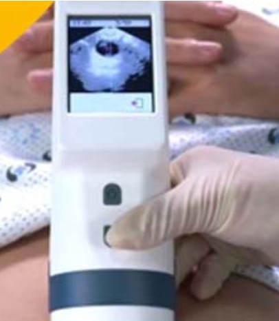 Bladderscan portable 900S + chargeur – Image 3