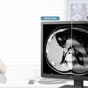 Ecran Médical LG 19HK312C-B  LED IPS 19" format 5:4e pour Endoscopie , Radiologie , Echographie , Bloc Opératoire